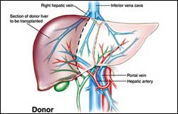 Live-Donor-Liver
